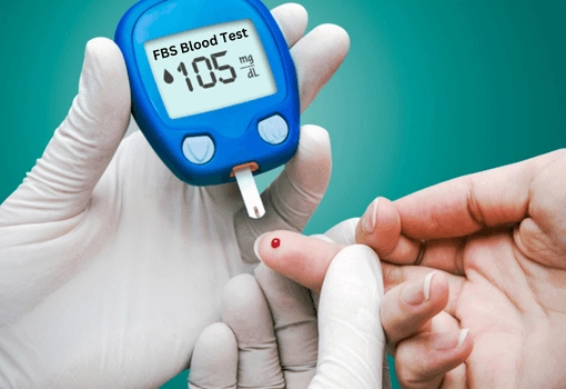 معنی FBS در ازمایش خون (1)