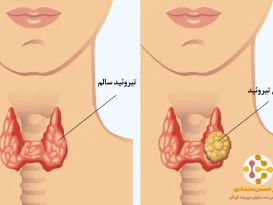 علائم تیروئید کم‌کار و پرکار