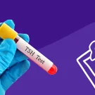 معنی TSH در آزمایش خون