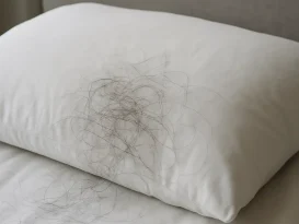 علت ریزش مو در خواب