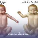 زردی نوزاد خطرناک است