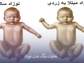 زردی نوزاد خطرناک است